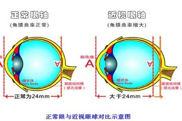 世博視視力矯正中心加盟