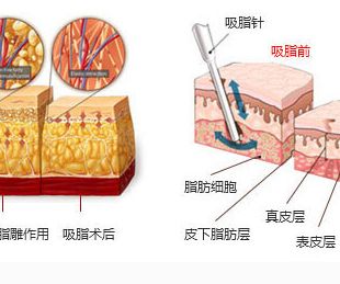 華美加盟